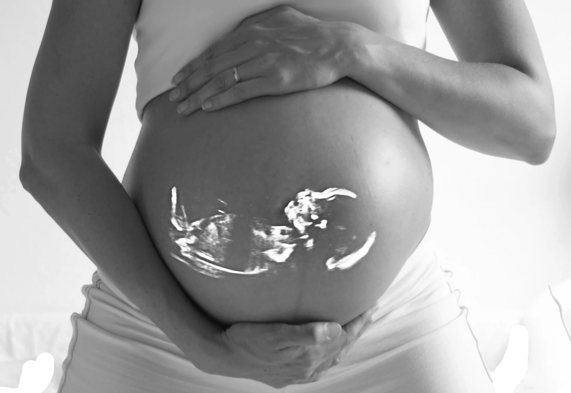 The case for Chiropractic care during pregnancy